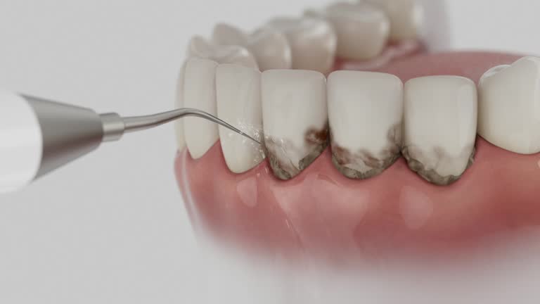 Trusted Tooth Extraction service in Coral Terrace, FL - Dentist Open Now